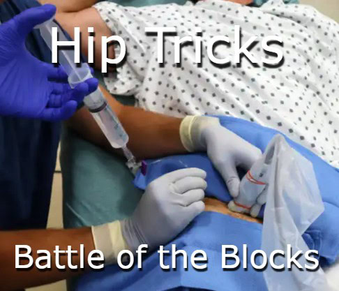 Hip Tricks: Battle of the Blocks